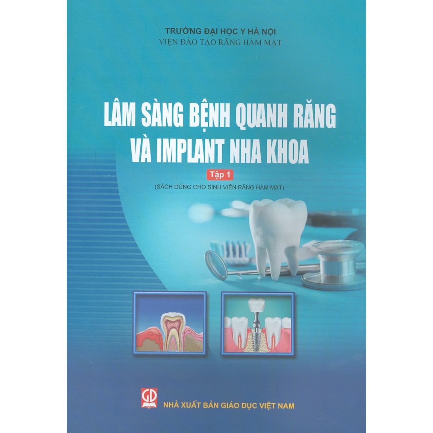 Lâm Sàng Bệnh Quanh Răng Và Implant Nha Khoa Tập 1 Sách Dùng Cho Sinh Viên Răng Hàm Mặt